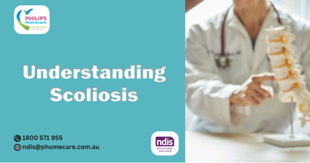 4 Things you need to know about of Scoliosis Signs, Symptoms & Treatment