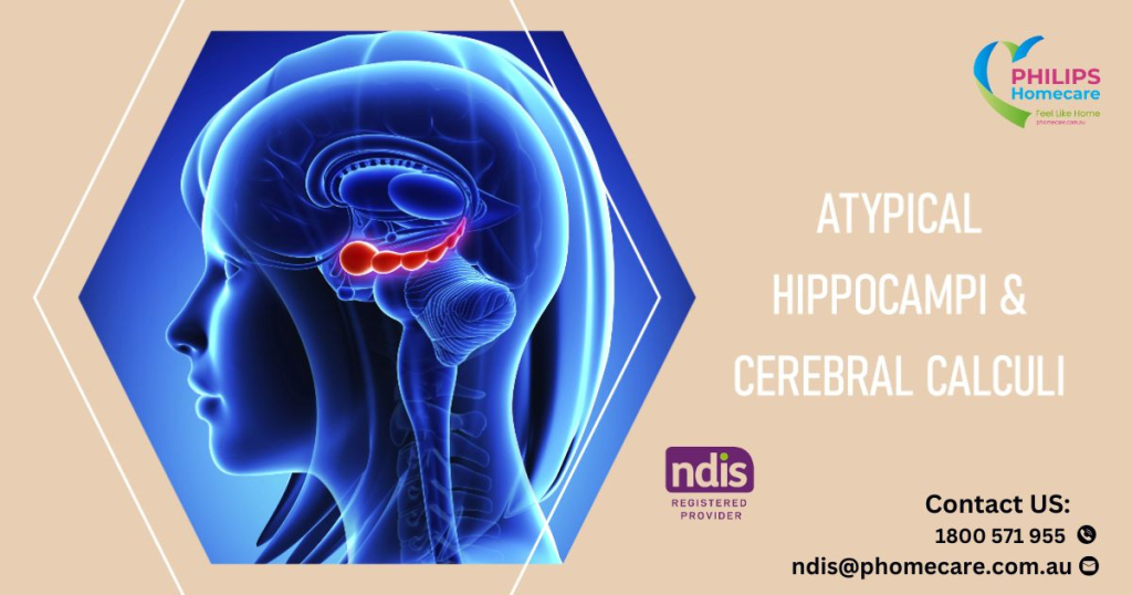 Implications, common symptoms and factors of atypical hippocampi in brain