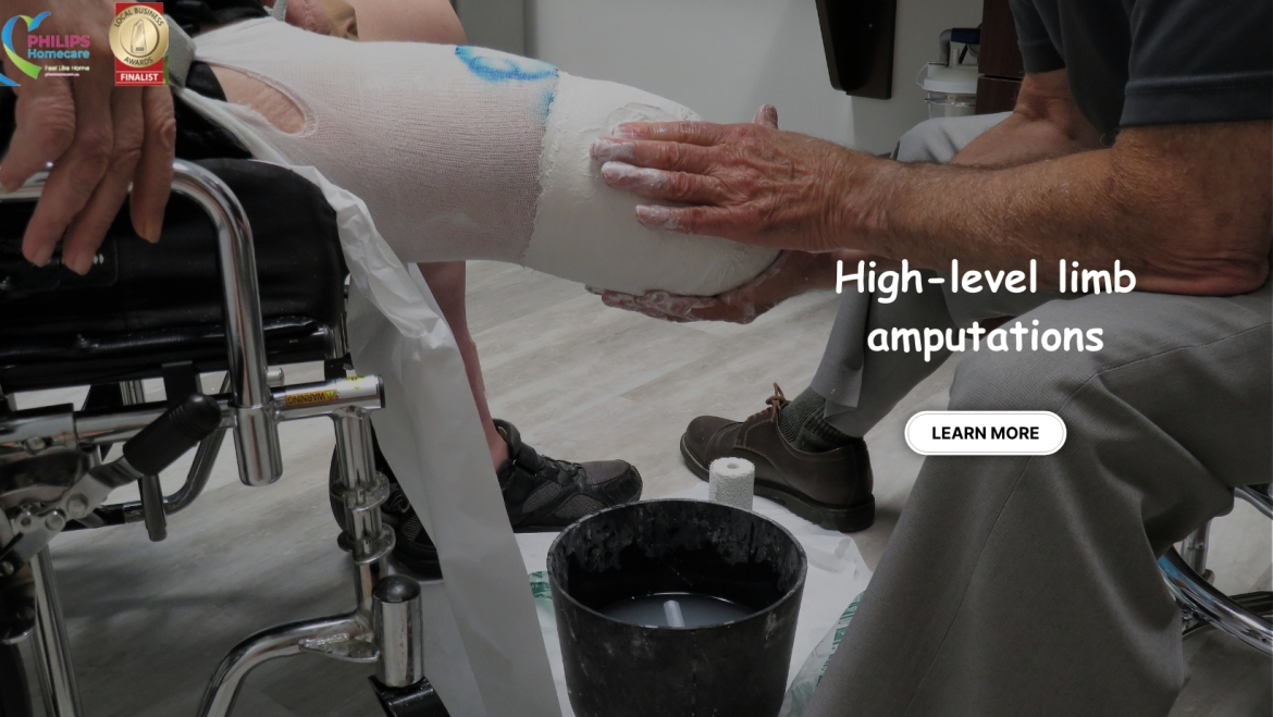 Multiple or high-level limb amputations